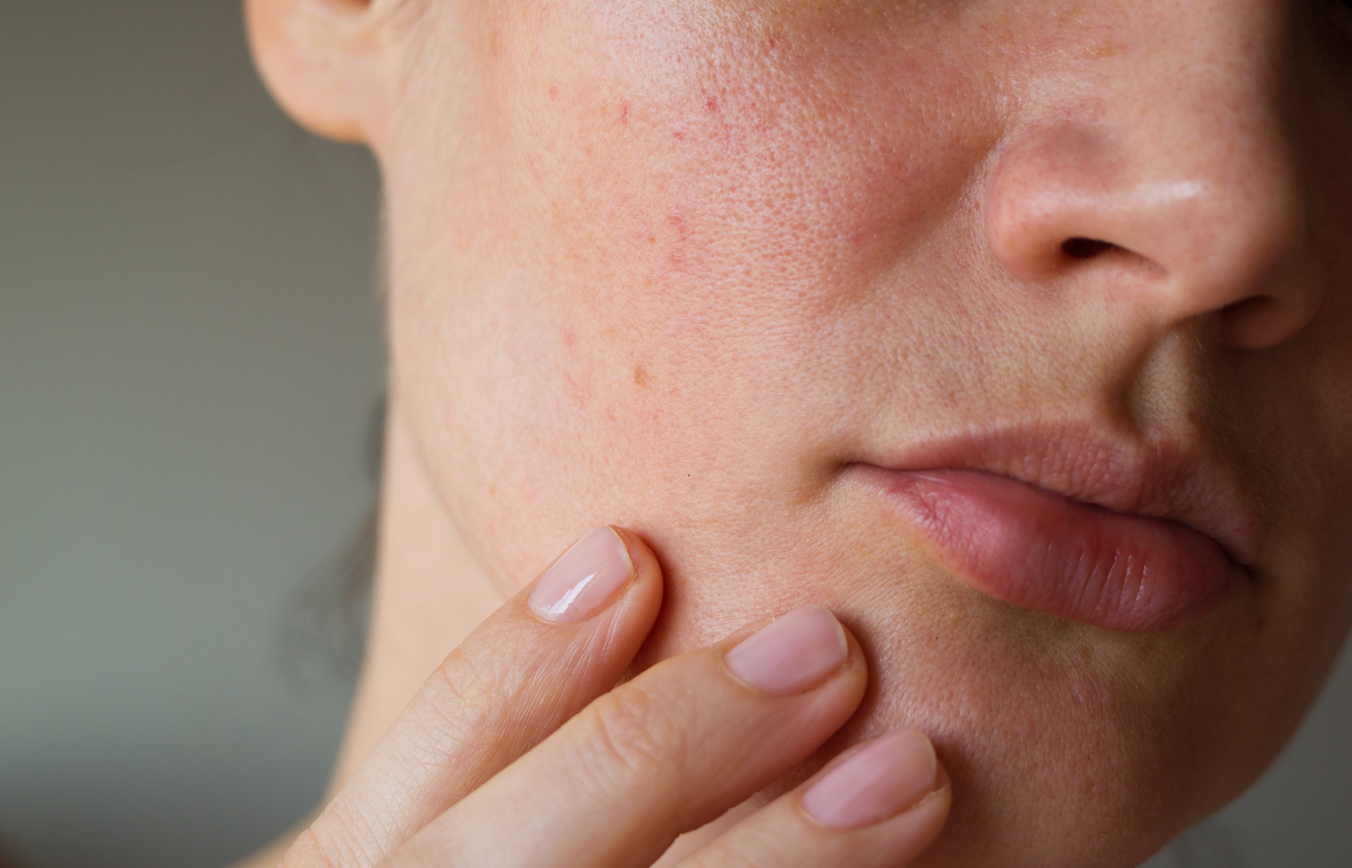 Phụ nữ trung niên mệt mỏi vì đối mặt với tình trạng da kém sắc, chảy sệ